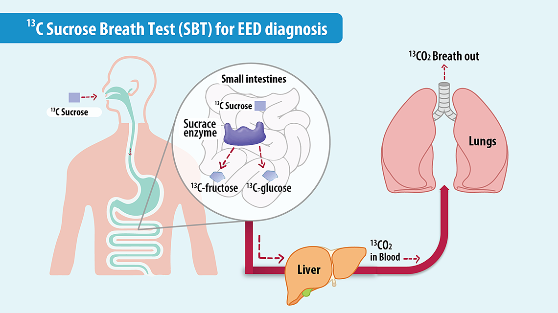 13c-sucrose-breath-test-eed-1140x640.png