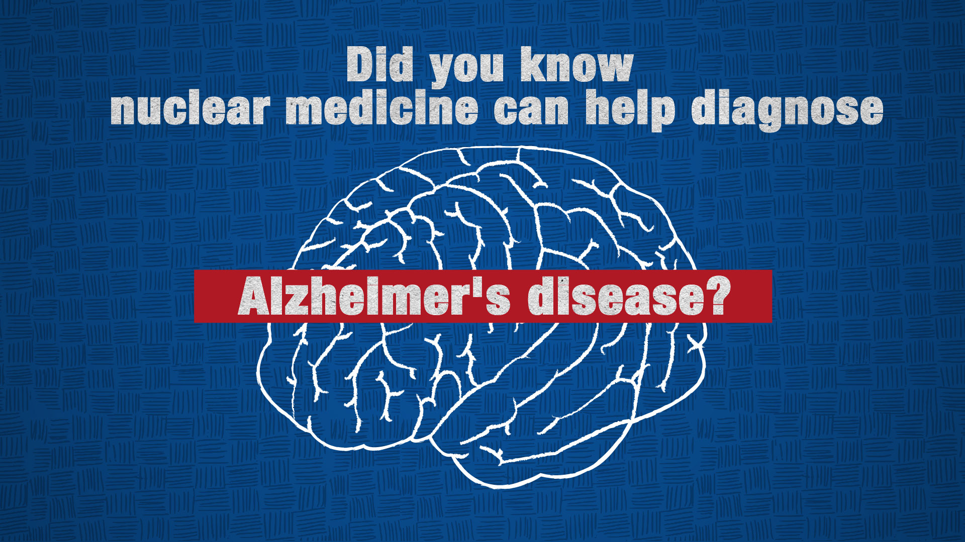 The Use of Molecular Imaging to Diagnose Alzheimers