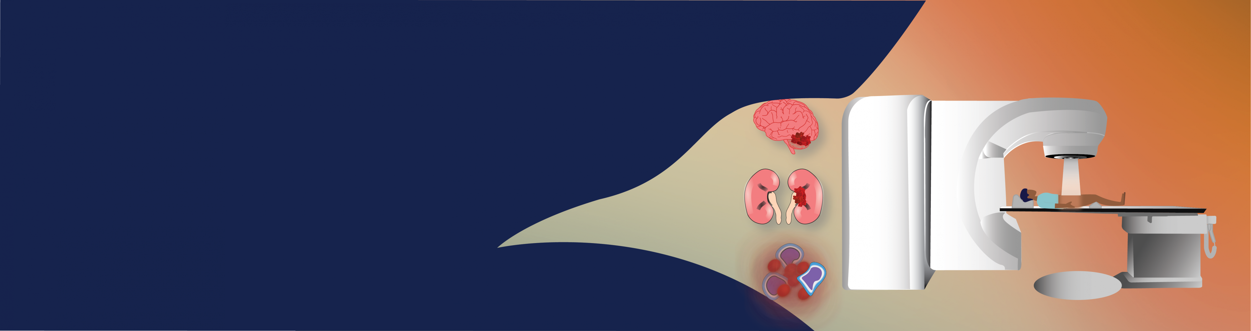 
<span>Childhood Cancer</span>
