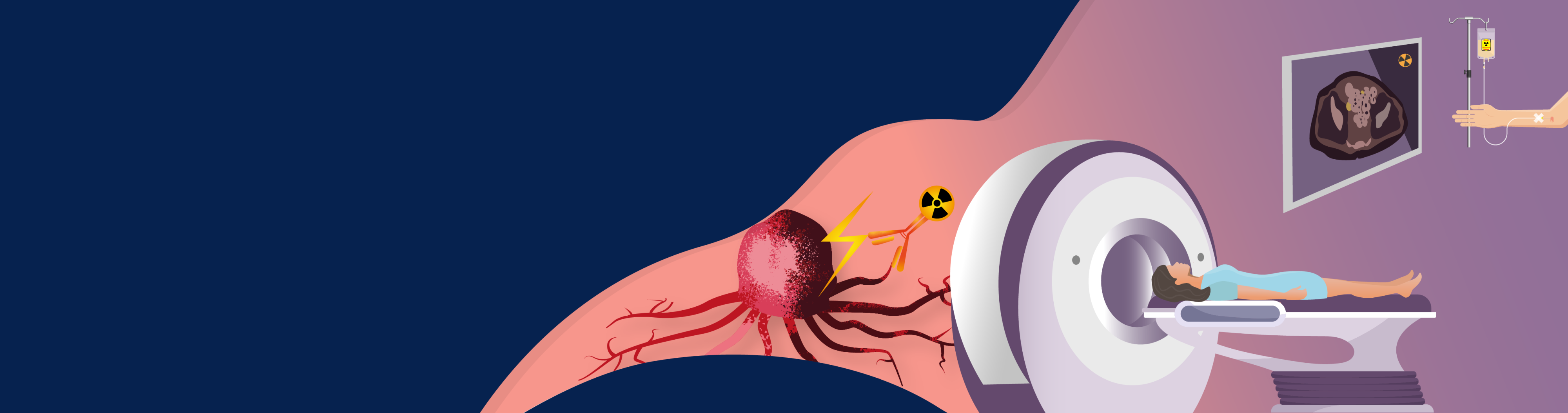 
<span>Nuclear Medicine</span>
