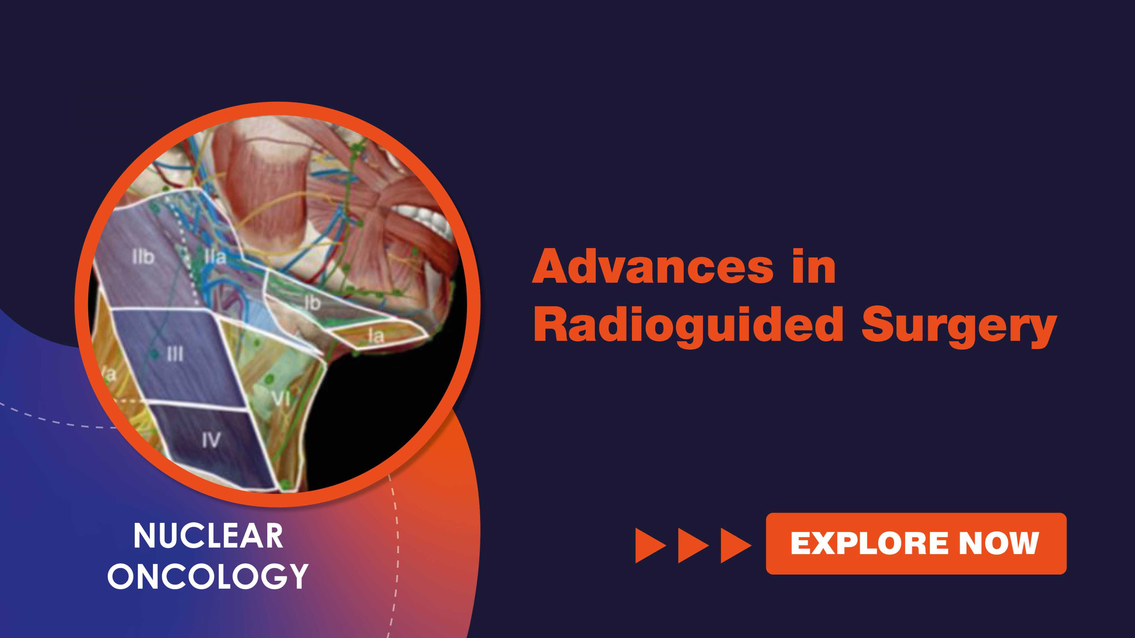 advancesinradioguidedsurgery-explr.jpg