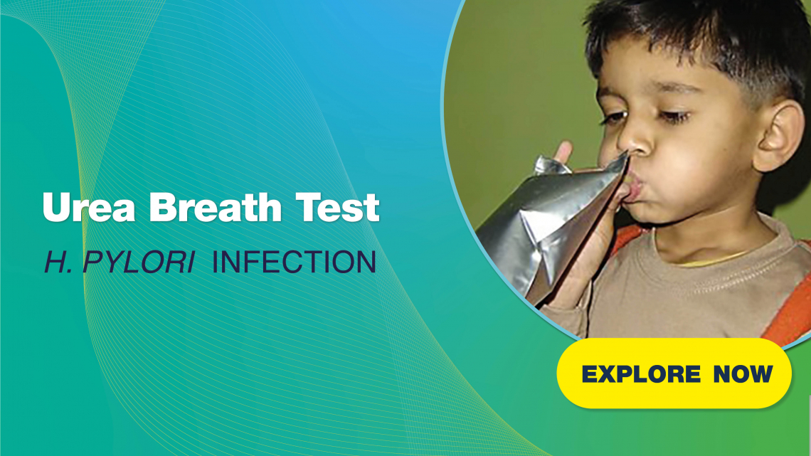 ureabreathtesthelicobacterpylori-v2.jpg
