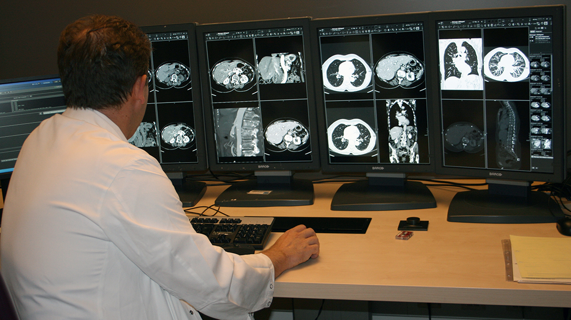 radiologist-reviewing-ct-scans-1140x640.jpg