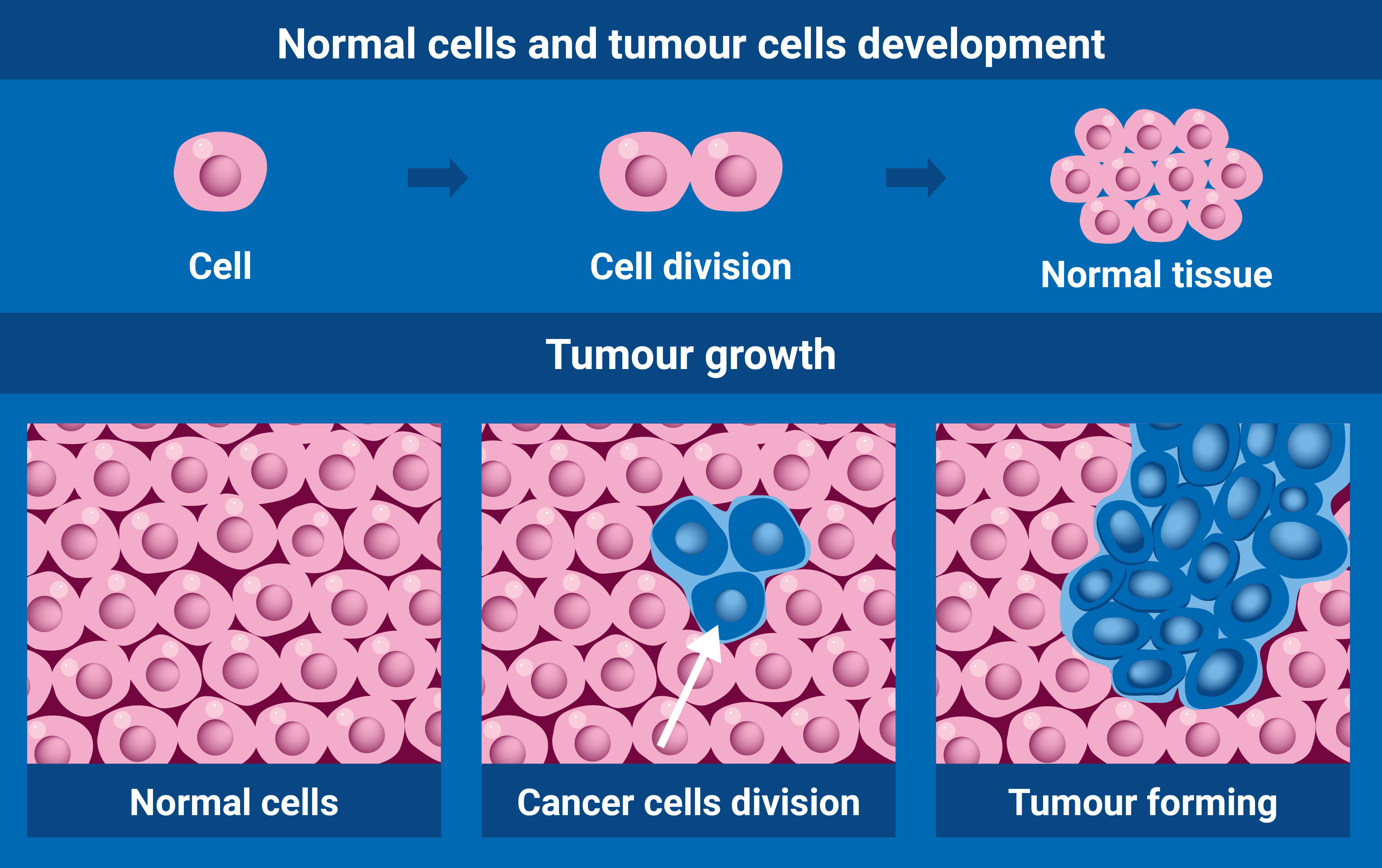 radiotherapy_v3_cancer_cell.jpg