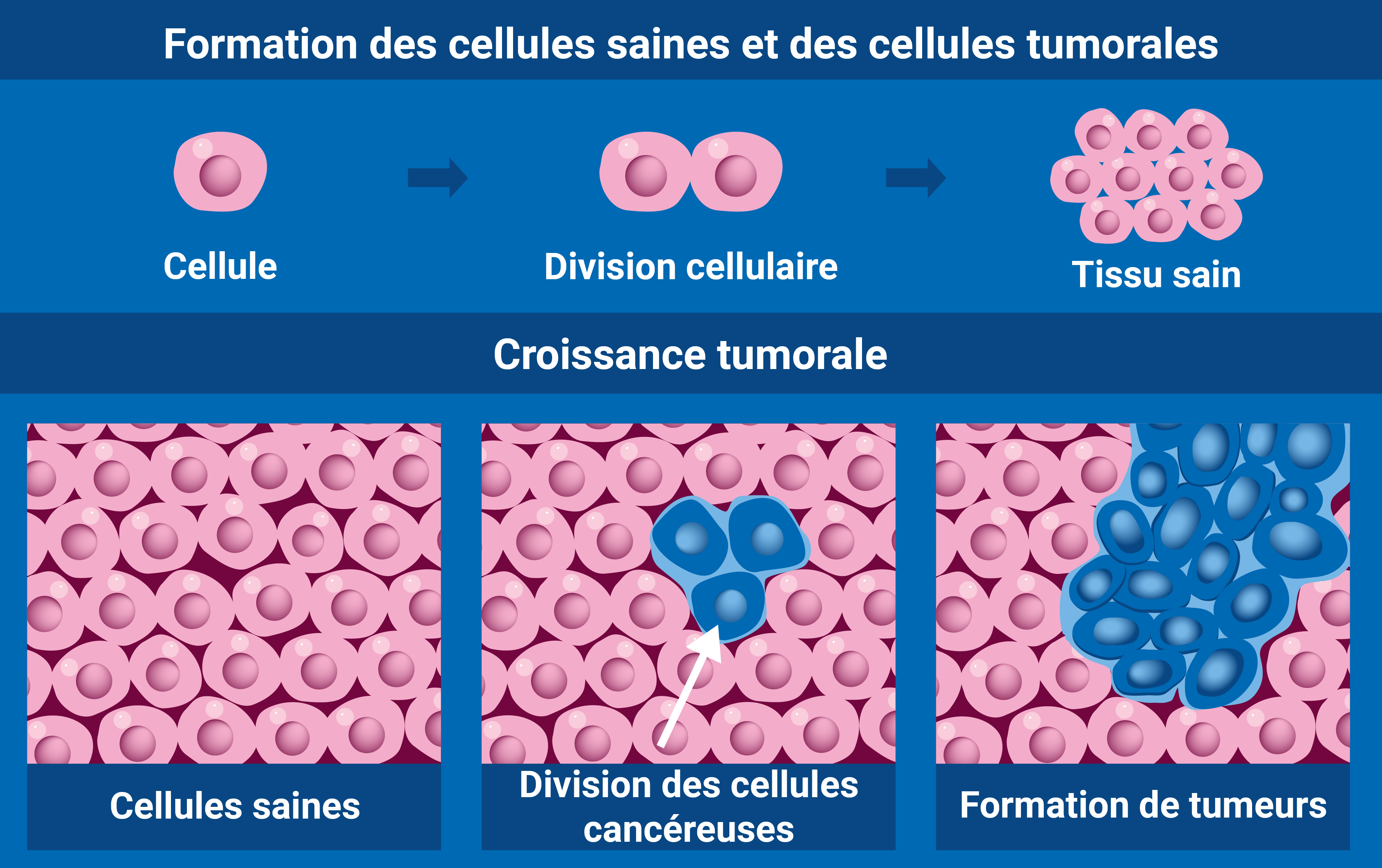 radiotherapy_v3_fr_cancer_cell.jpg