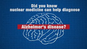 The Use of Molecular Imaging to Diagnose Alzheimers