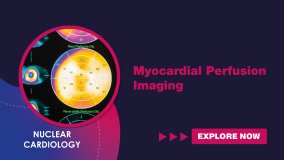 Myocardial Perfusion Imaging