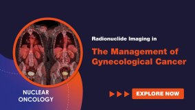 Radionuclide Imaging In The Management Of Gynecological Cancer