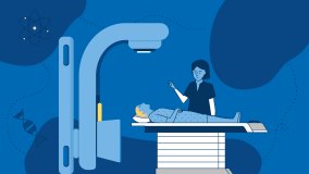 Image showing external radiotherapy, or teletherapy, which is one of the common treatments for cancer.