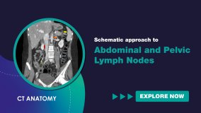 Schematic Approach to Abdominal and Pelvic Lymph Nodes (English)