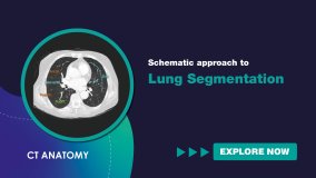 Schematic Approach to Lung Segmentation