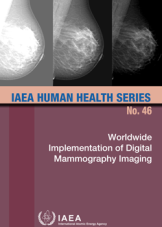 Worldwide Implementation of Digital Mammography Imaging