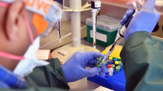 Real time RT-PCR is the most accurate method to detect the COVID-19 virus
